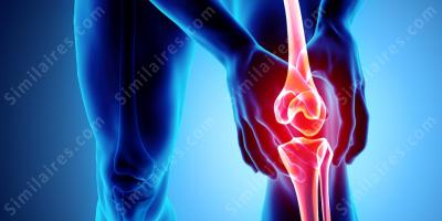 arthrite films arthrite films