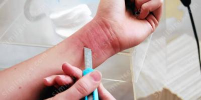 auto-mutilation films