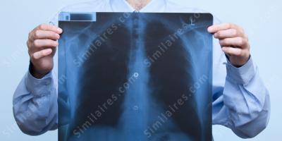 cancer du poumon films