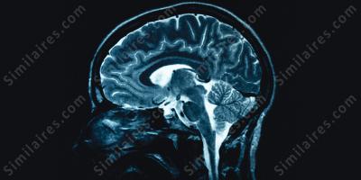 scanner cérébral films
